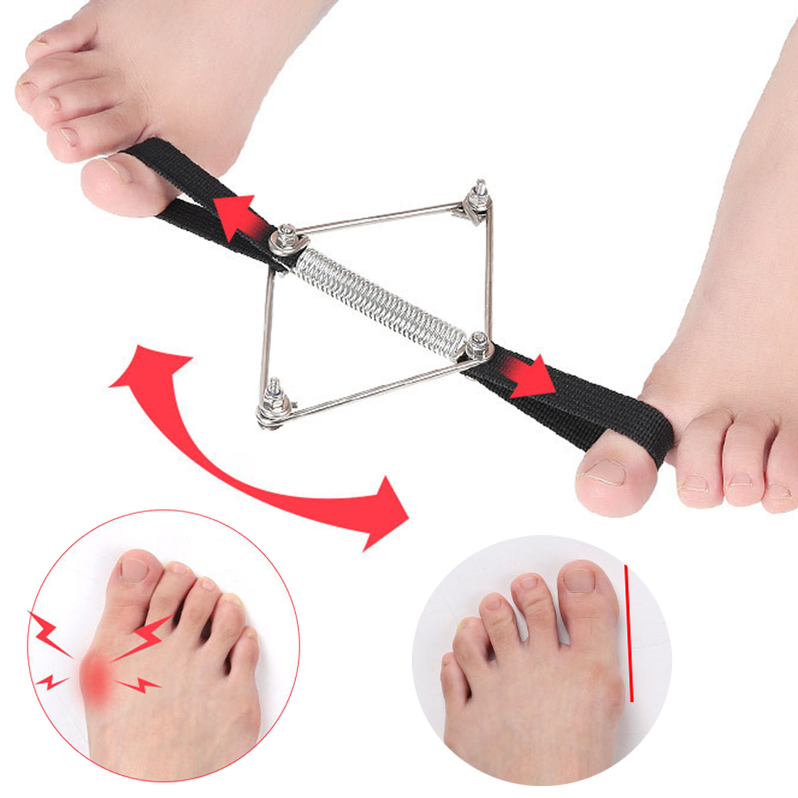 Bunion Corrector Nylon Staal Z - Pilates Yoga Wellness recensie en prijs